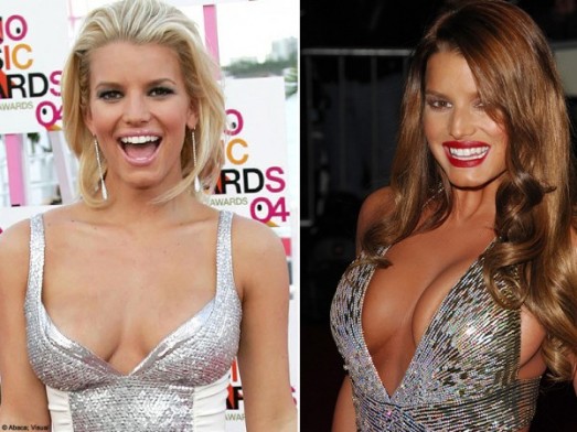 Stars : les ratés de la chirurgie esthétique Jessica Simpson