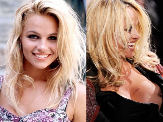 Stars : les ratés de la chirurgie esthétique Pamela Anderson
